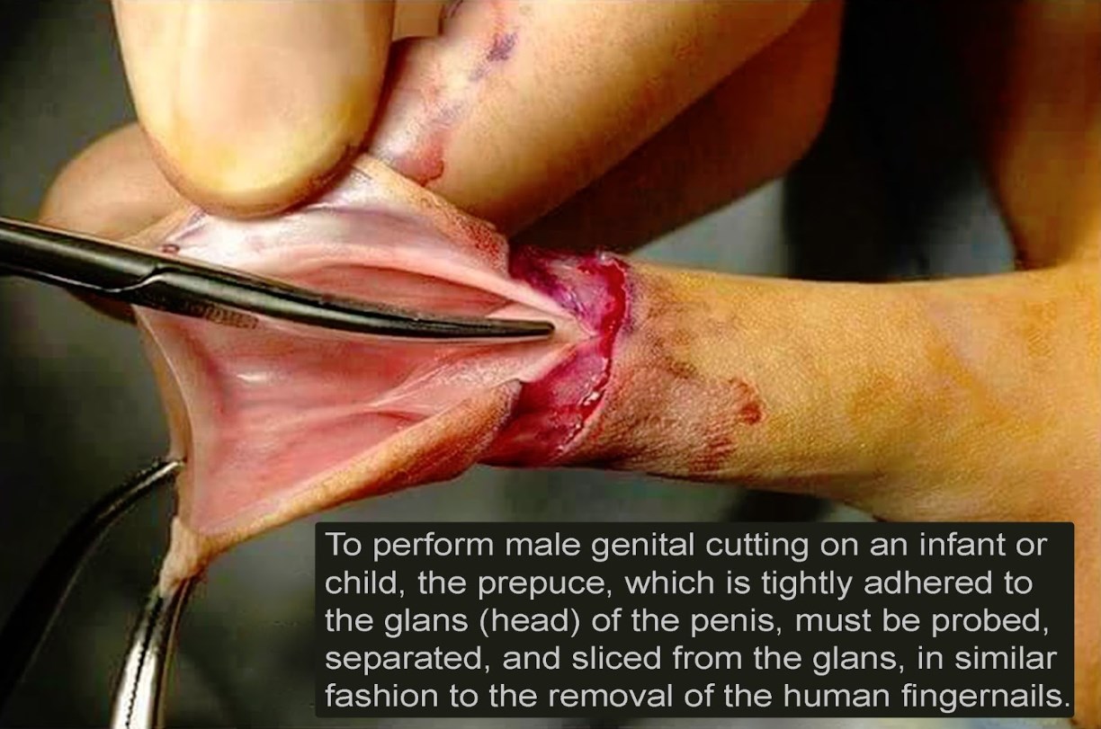 Penis Mutilation 25